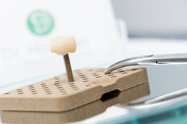 Zahnersatz in der Zahnarztpraxis in Parsberg
